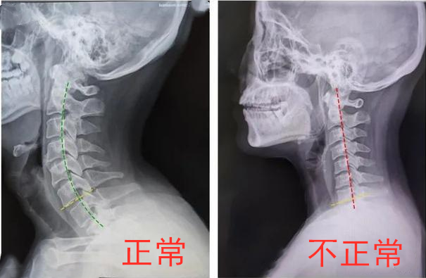 曲度.png