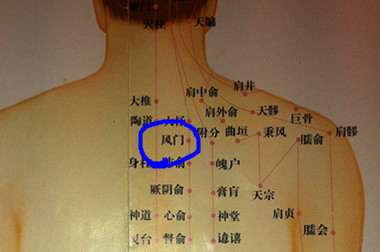 拔罐 拔背——立竿见影的疗效